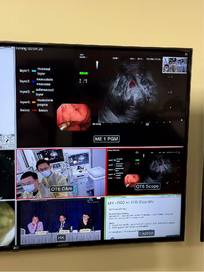 IDDF 2026 - Live Endoscopy Demonstration in Singapore Iddf Live Demo 02