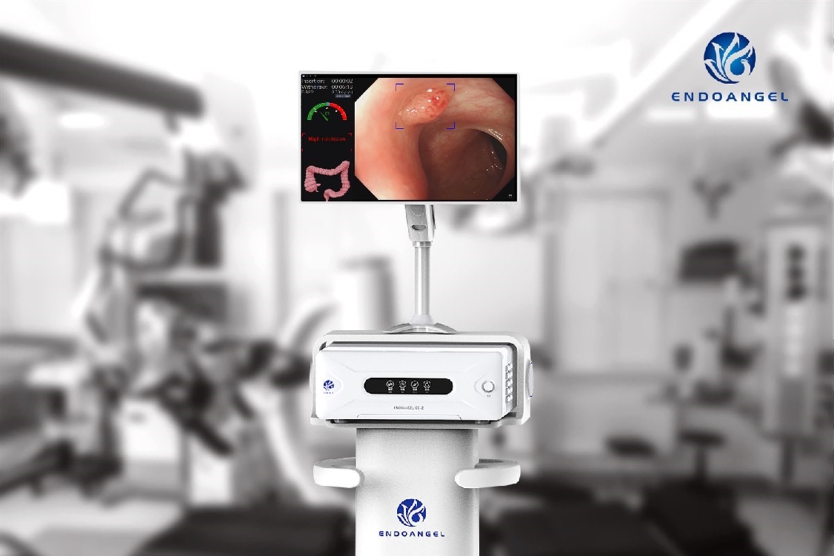 EndoAngel colonoscopy AI assistant in clinical use