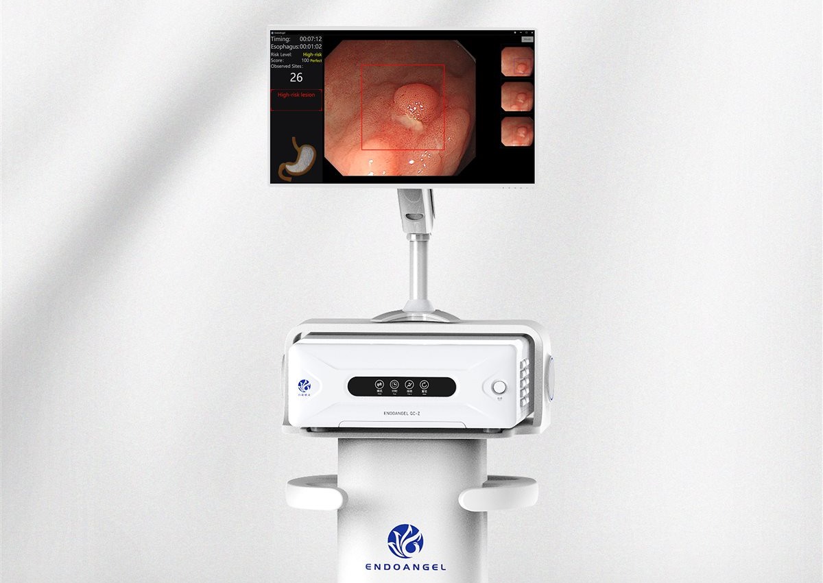Endoscopist performing AI-assisted colonoscopy with EndoAngel system at hospital