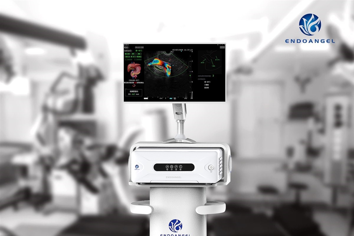 EndoAngel EUS AI assistant in clinical use